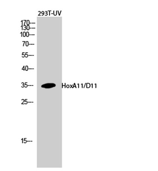 HoxA11/D11 antibody