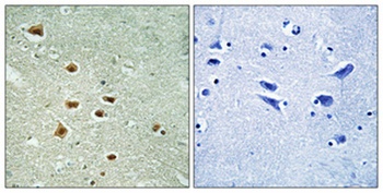 HoxA11/D11 rabbit pAb