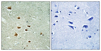 HoxA11/D11 antibody