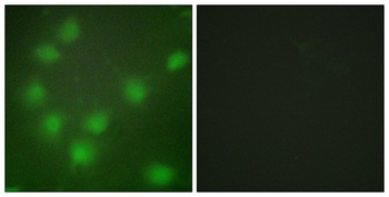 HoxA11/D11 rabbit pAb