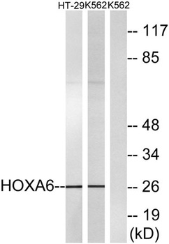 HoxA6 rabbit pAb