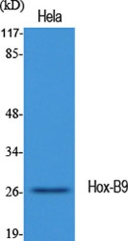 Hox-B9 rabbit pAb Antibody