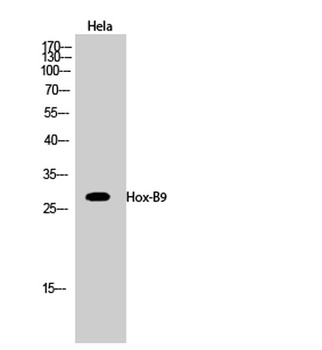 Hox-B9 rabbit pAb Antibody