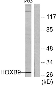 Hox-B9 rabbit pAb Antibody