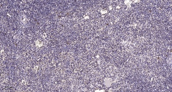 Hox-B9 rabbit pAb Antibody