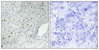 HPK1 antibody