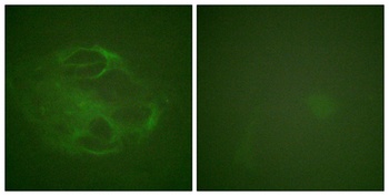 Hrs antibody