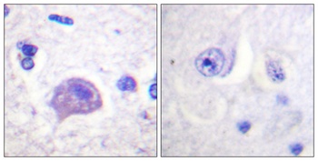 Hrs antibody