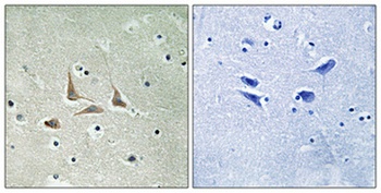 HSF-27 antibody