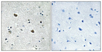 HSP70 antibody