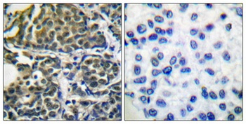 HSP90 beta antibody