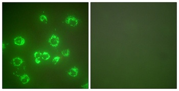 HSP A9 antibody