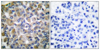 HSP A9 antibody