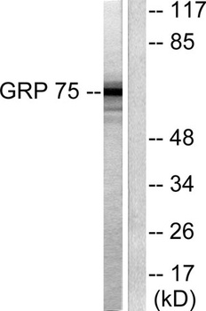 HSP A9 antibody