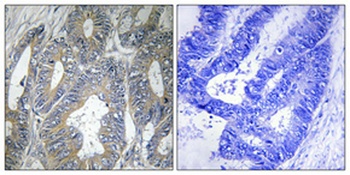 HSP β2 rabbit pAb