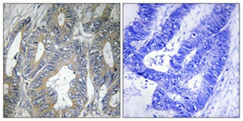 HSP beta 2 antibody