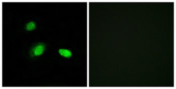 HSP β2 rabbit pAb