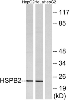 HSP beta 2 antibody