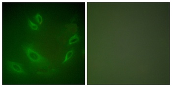 HSP105 rabbit pAb Antibody