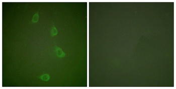 HSP40 rabbit pAb