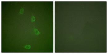 HSP40 antibody