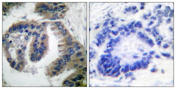 HSP40 antibody