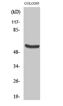 HSP60 antibody