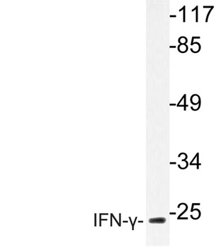 IFN gamma antibody