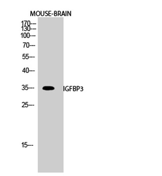 IGFBP3 antibody