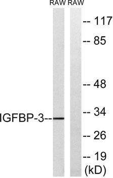 IGFBP3 rabbit pAb