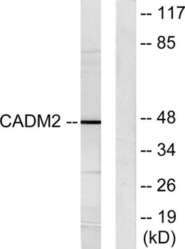 IGSF4D antibody