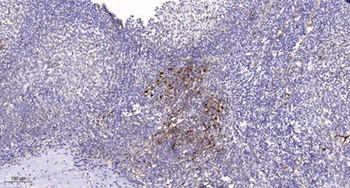 IGSF4D antibody
