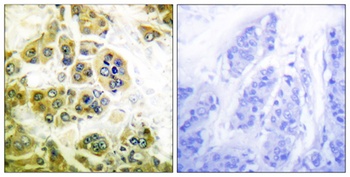 IKK alpha/beta antibody