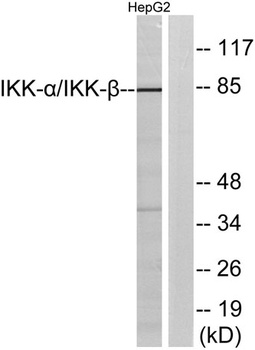 IKK alpha/beta antibody