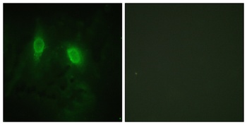 IKK gamma antibody