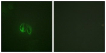 IL10R alpha antibody