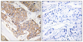 IL-13Rα1 rabbit pAb