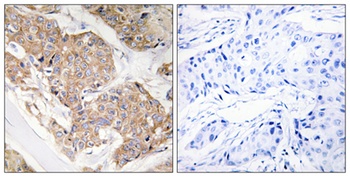 IL13R alpha 1 antibody