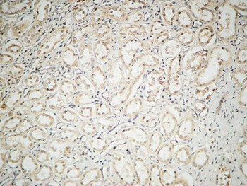 IL2 antibody