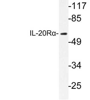 IL20R alpha antibody