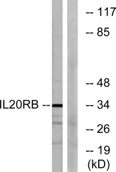 IL20R beta antibody