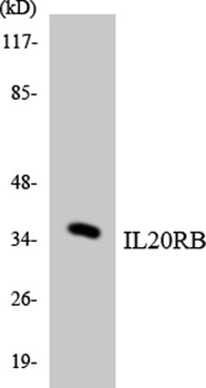 IL20R beta antibody