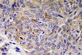 IL32 antibody