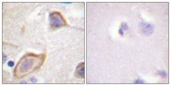 IL3R beta antibody