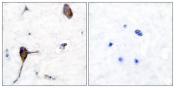 IL3R beta antibody