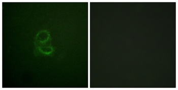 IL-4Rα rabbit pAb