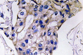 IL5 antibody