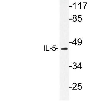 IL5 antibody