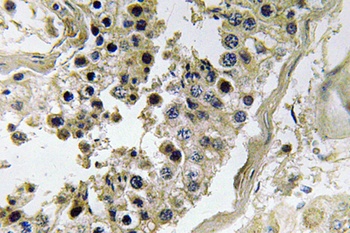 Inhibin beta-C antibody