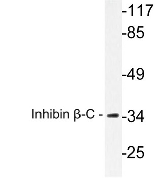 Inhibin β-C rabbit pAb